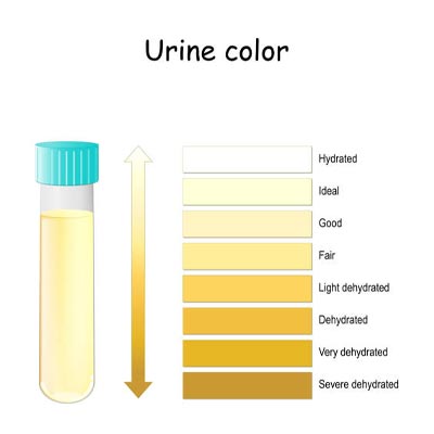 Urine trouble