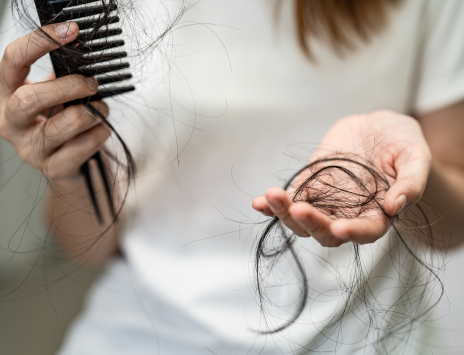 perte de cheveux